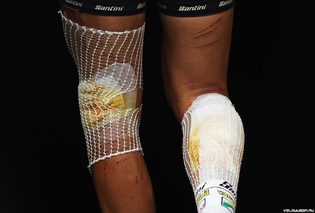 Не только для ходьбы. Что бывает с ногами велосипедистов на Tour de France